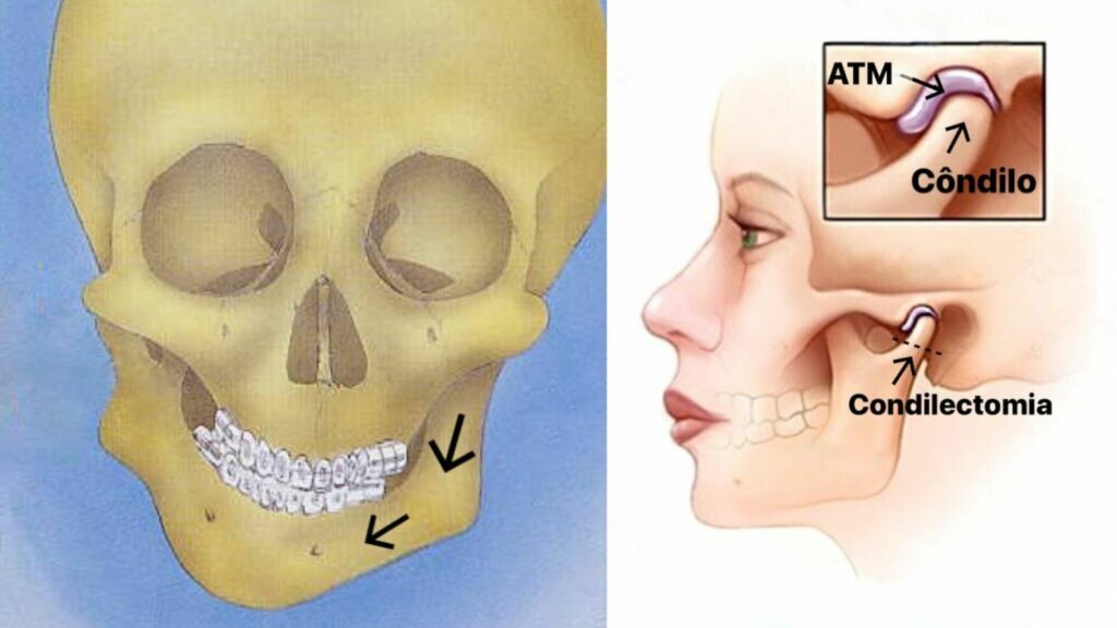 atm iguanambi Primeira cirurgia de ATM é realizada no SUS de Guanambi pelo Dr. Yuri Slusarenko